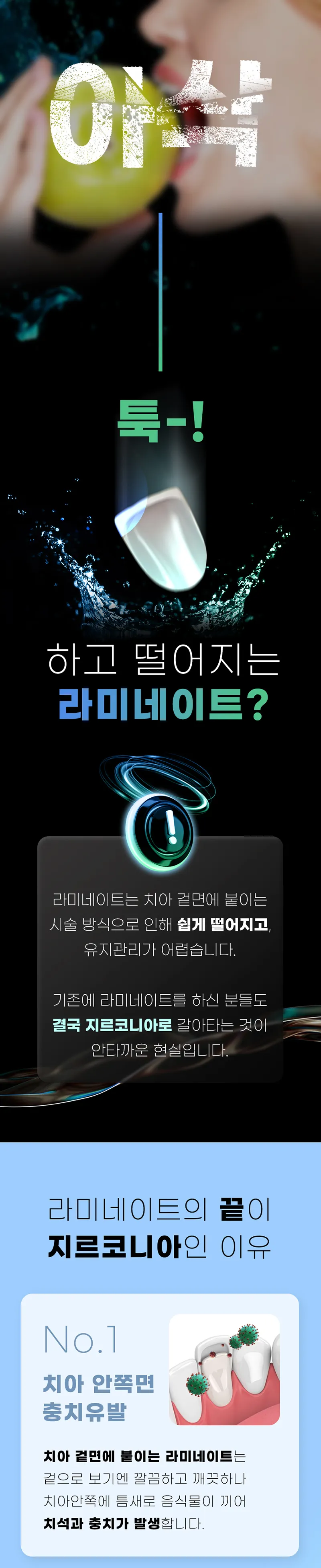 오른치과의원 라미네이트 절대 하지마세요 지르코니아 이벤트, 시술 상세 이미지