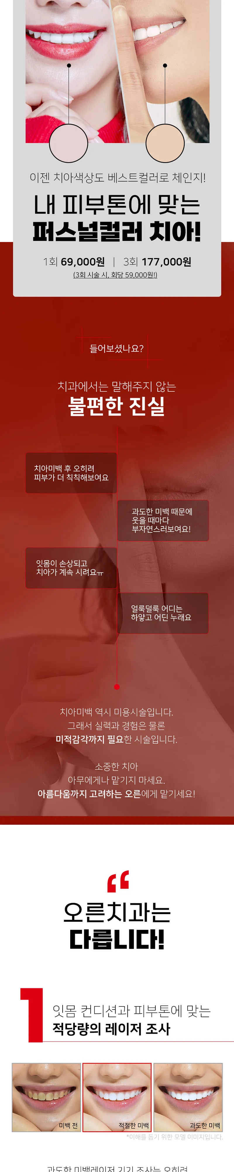 오른치과의원 치아미백 원데이 30분이면 끝! 이벤트, 시술 상세 이미지