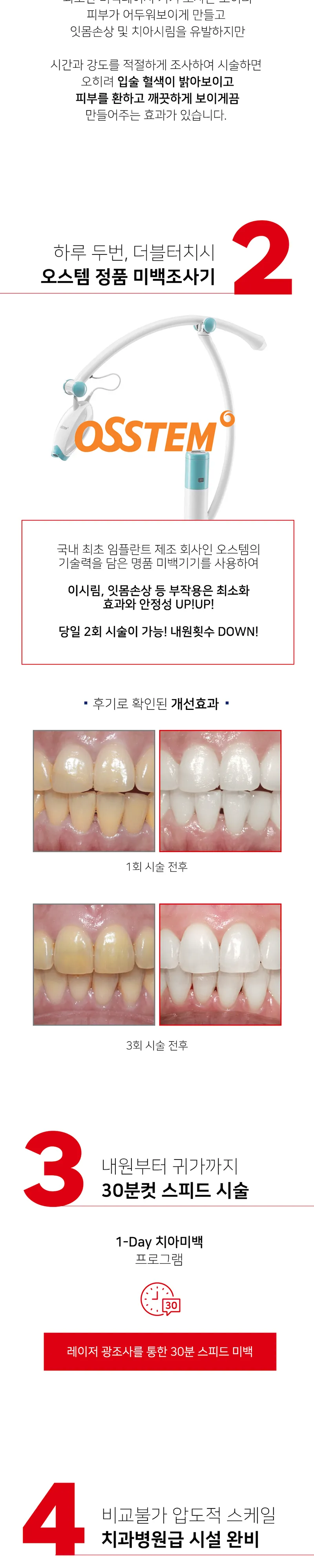 오른치과의원 새학기 개강여신 치아미백 이벤트, 시술 상세 이미지