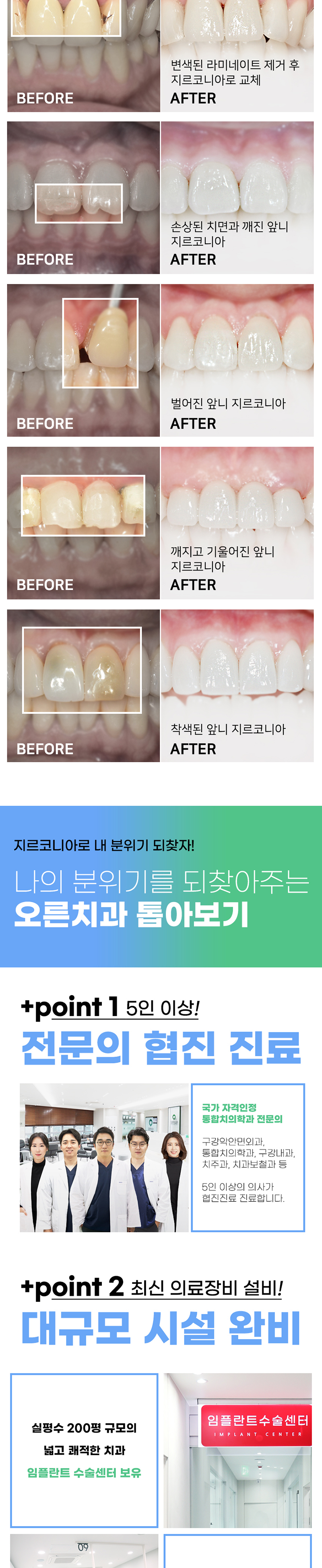 오른치과의원 튼튼하고 예쁜 지르코니아 앞니성형 이벤트, 시술 상세 이미지