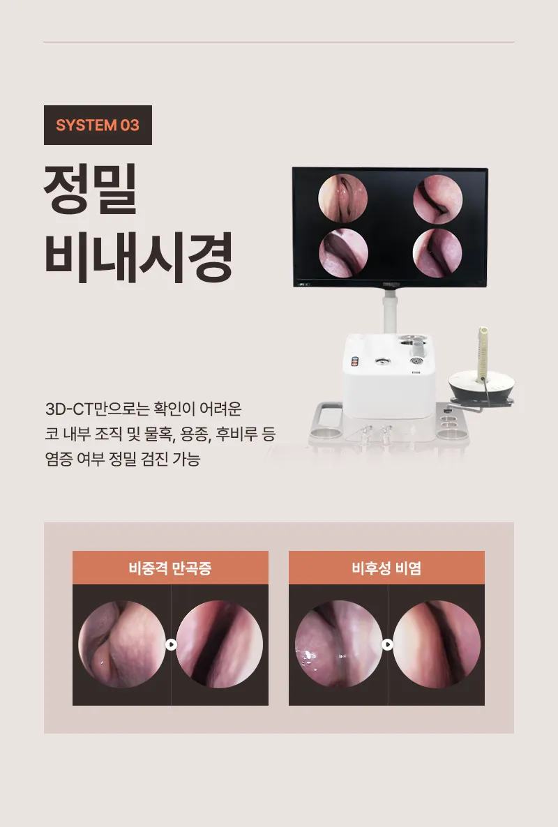 뷰성형외과 ❤️뷰❤️기능코성형 이벤트, 시술 상세 이미지