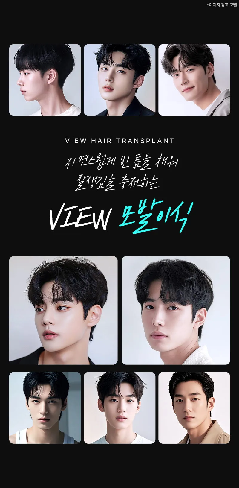 뷰성형외과 ❤뷰❤모발이식 이벤트, 시술 상세 이미지