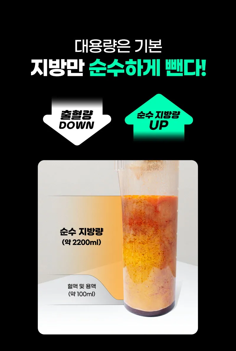 뷰성형외과 ❤️뷰❤️대용량 지방흡입 이벤트, 시술 상세 이미지