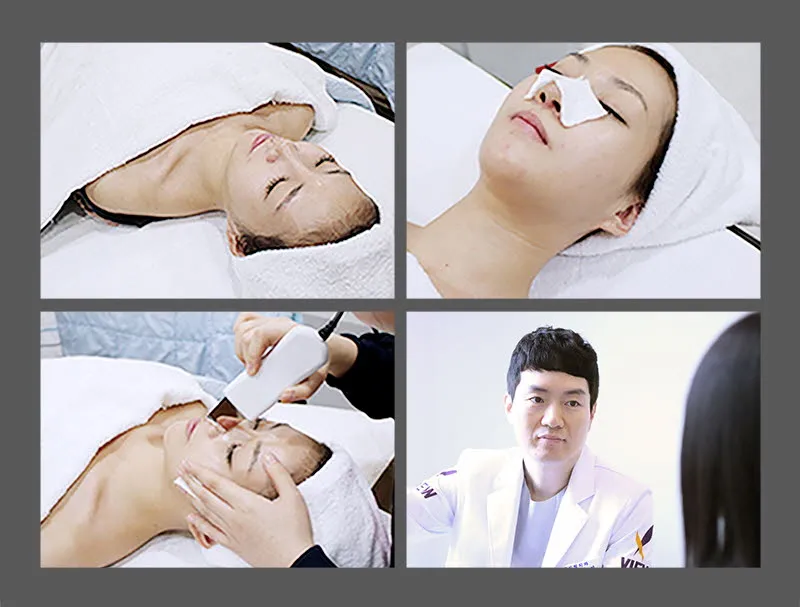 뷰성형외과 ❤️뷰❤️기능코성형 이벤트, 시술 상세 이미지
