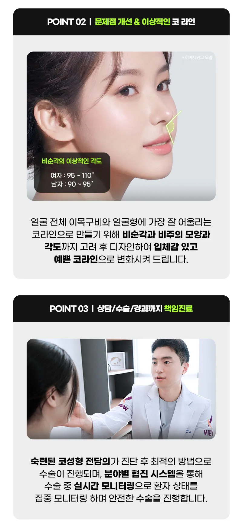 뷰성형외과 ❤️뷰❤️코재수술 이벤트, 시술 상세 이미지