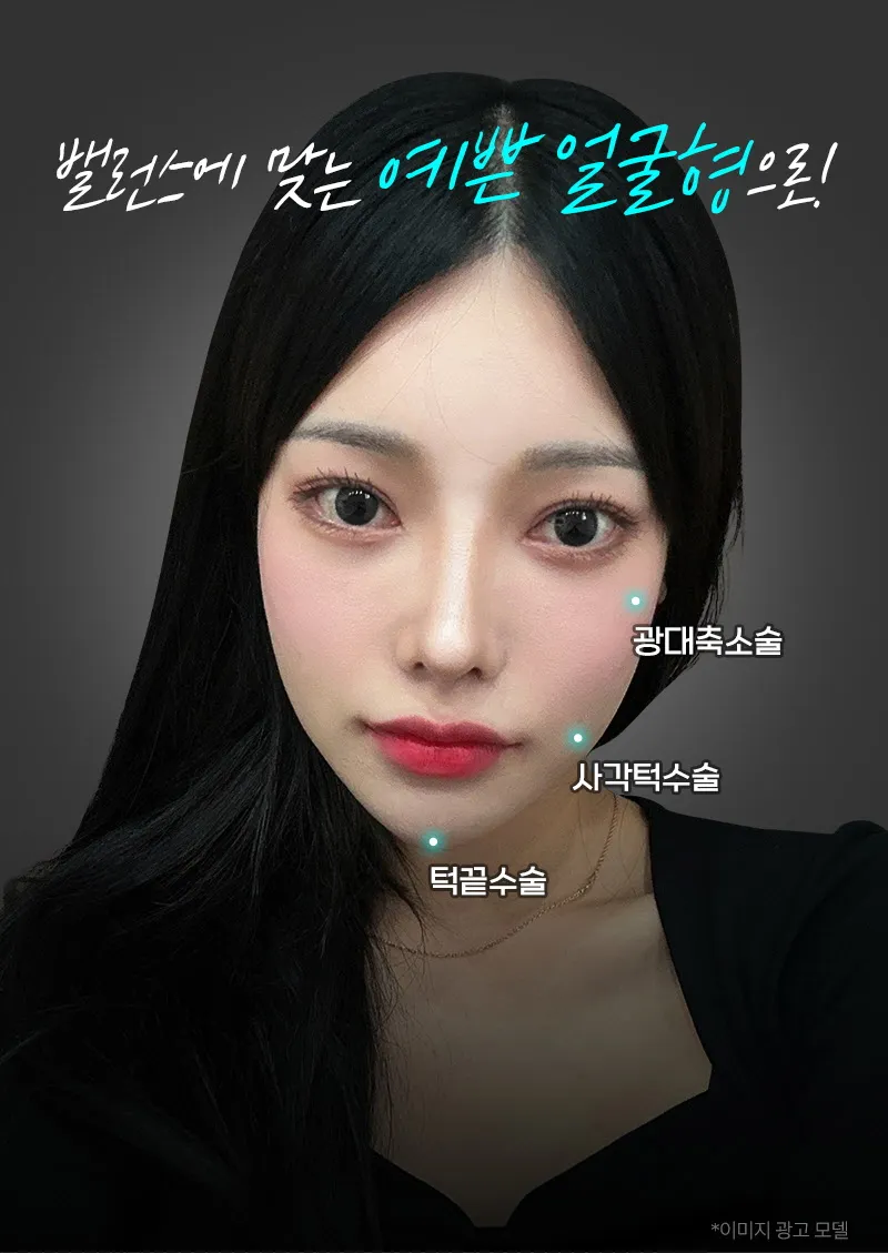 뷰성형외과 ❤️뷰❤️안면윤곽 이벤트, 시술 상세 이미지