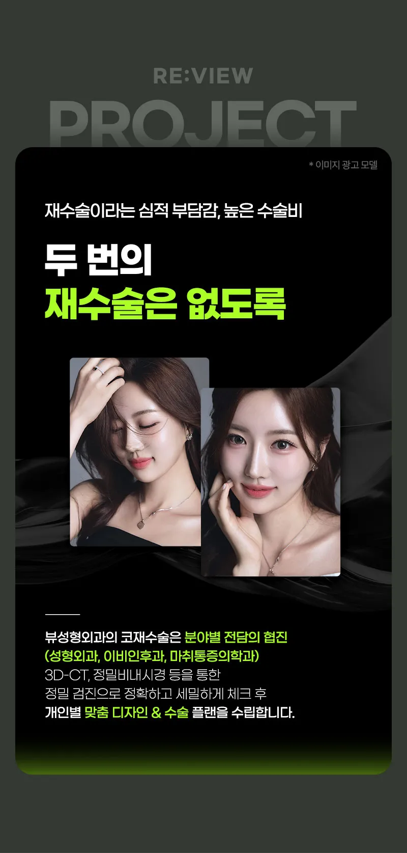 뷰성형외과 ❤️뷰❤️코재수술 이벤트, 시술 상세 이미지