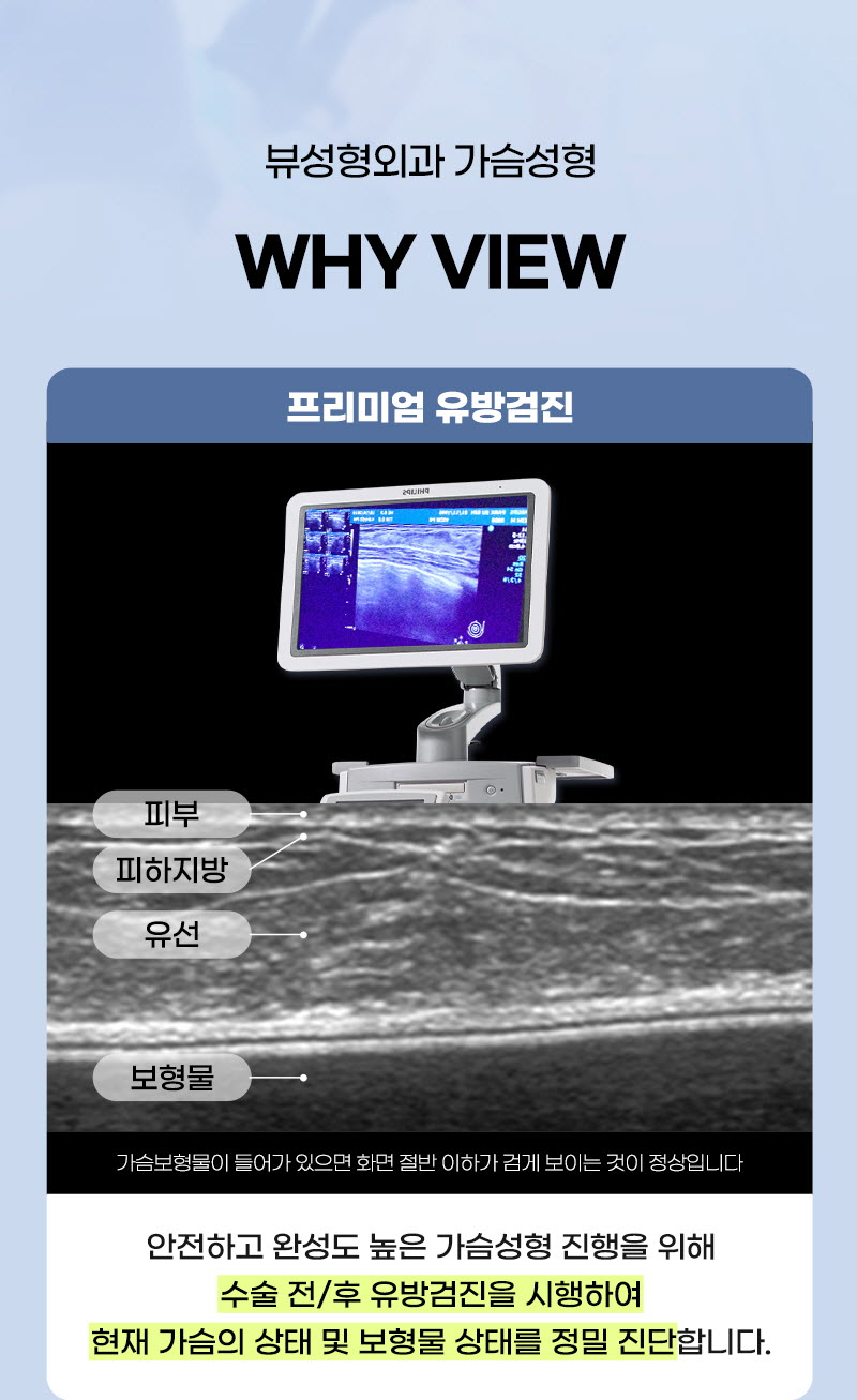 뷰성형외과 ❤️뷰❤️UIU 멘토 엑스트라 이벤트, 시술 상세 이미지