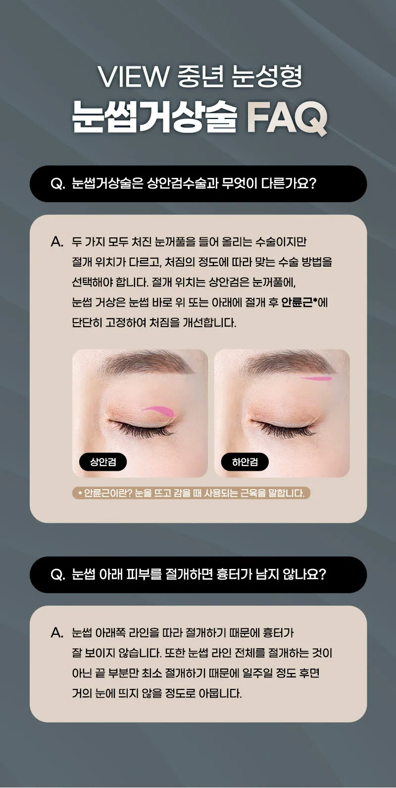 뷰성형외과 ❤️뷰❤️눈썹거상술 이벤트, 시술 상세 이미지