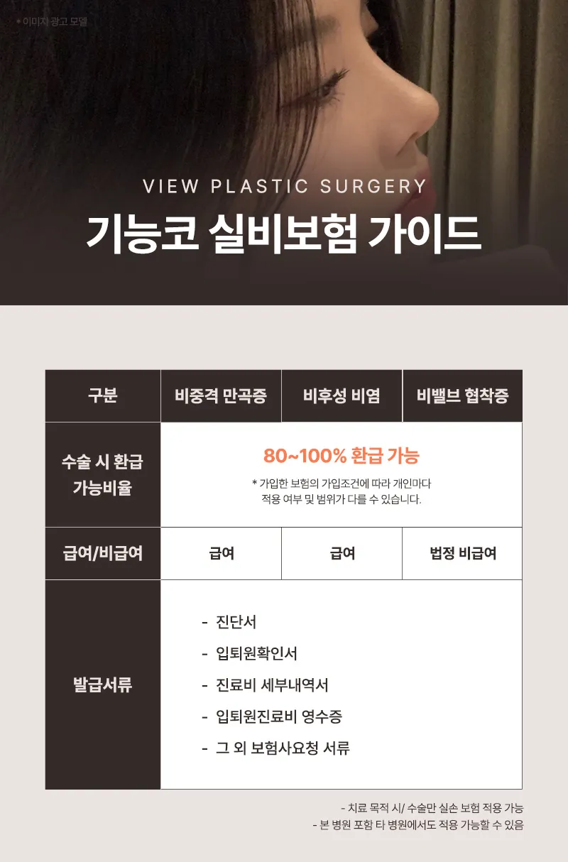뷰성형외과 ❤️뷰❤️기능코성형 이벤트, 시술 상세 이미지