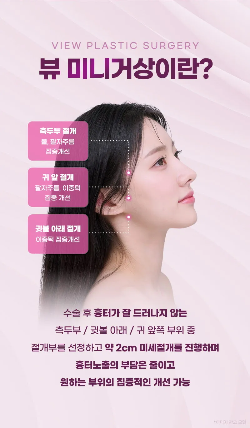 뷰성형외과 ❤뷰❤미니거상 이벤트, 시술 상세 이미지