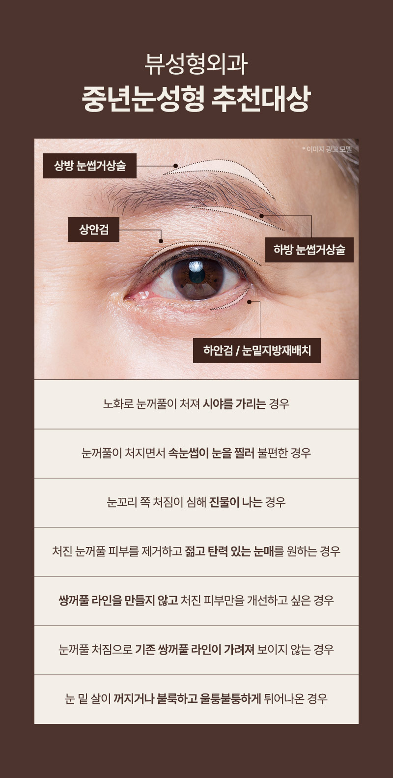 ❤️뷰❤️중년 눈성형