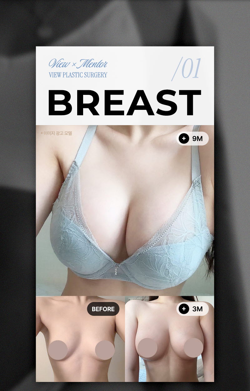 뷰성형외과 ❤️뷰❤️UIU 멘토 엑스트라 이벤트, 시술 상세 이미지