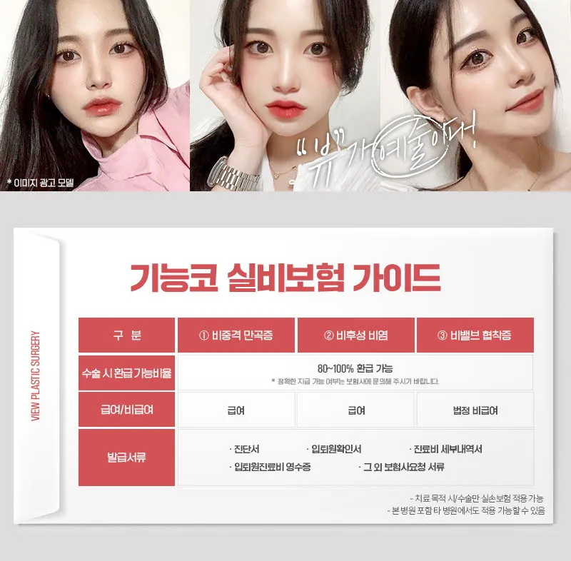 뷰성형외과 ❤️뷰❤️기능코성형 이벤트, 시술 상세 이미지