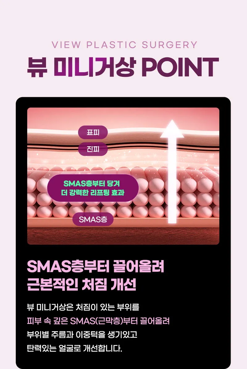 뷰성형외과 ❤뷰❤미니거상 이벤트, 시술 상세 이미지