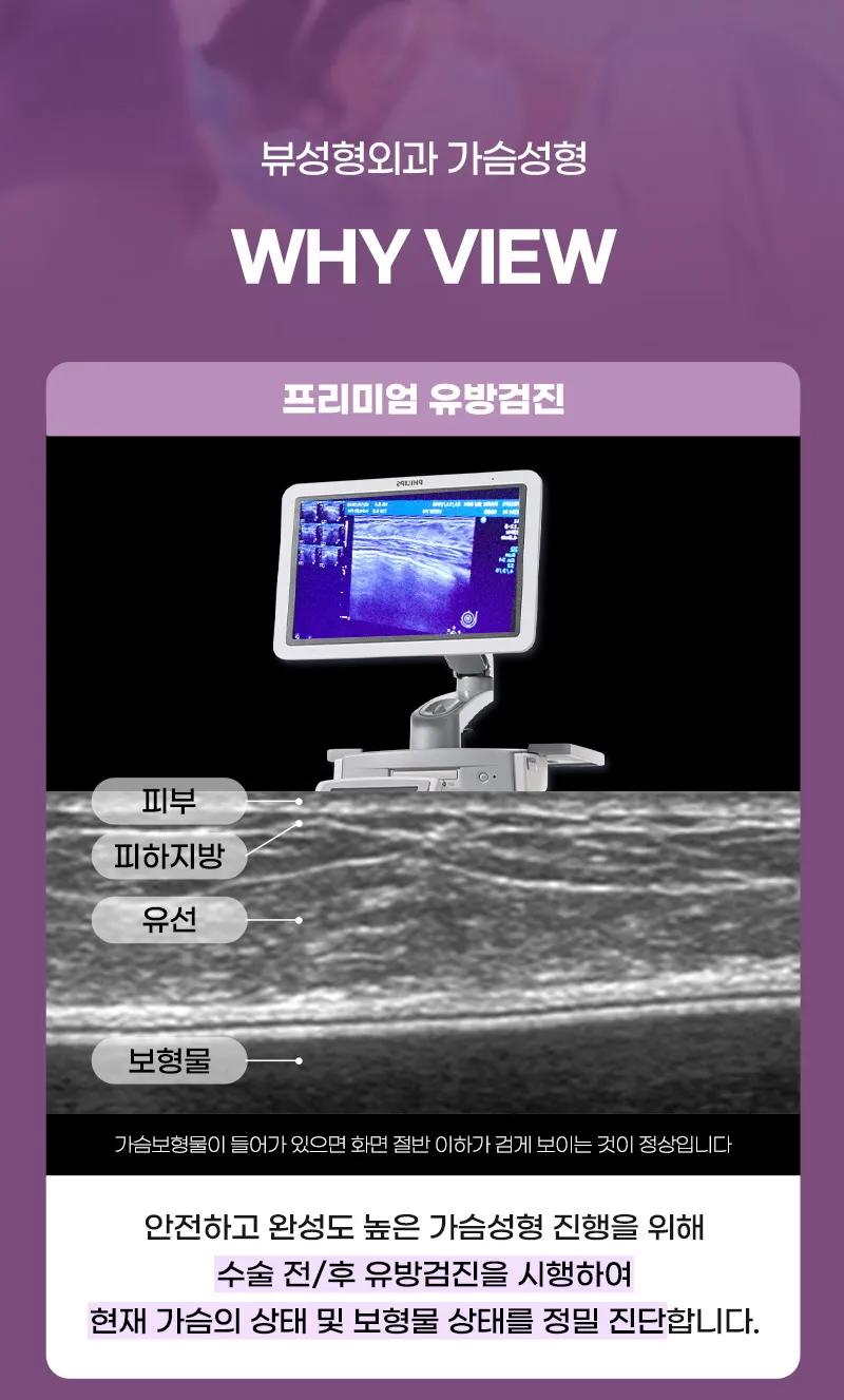 뷰성형외과 ❤️뷰❤️ 모티바 가슴성형 이벤트, 시술 상세 이미지