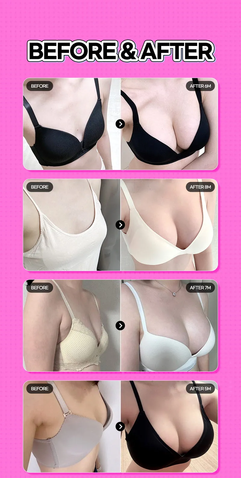 뷰성형외과 ❤️뷰❤️멘토 부스트 이벤트, 시술 상세 이미지