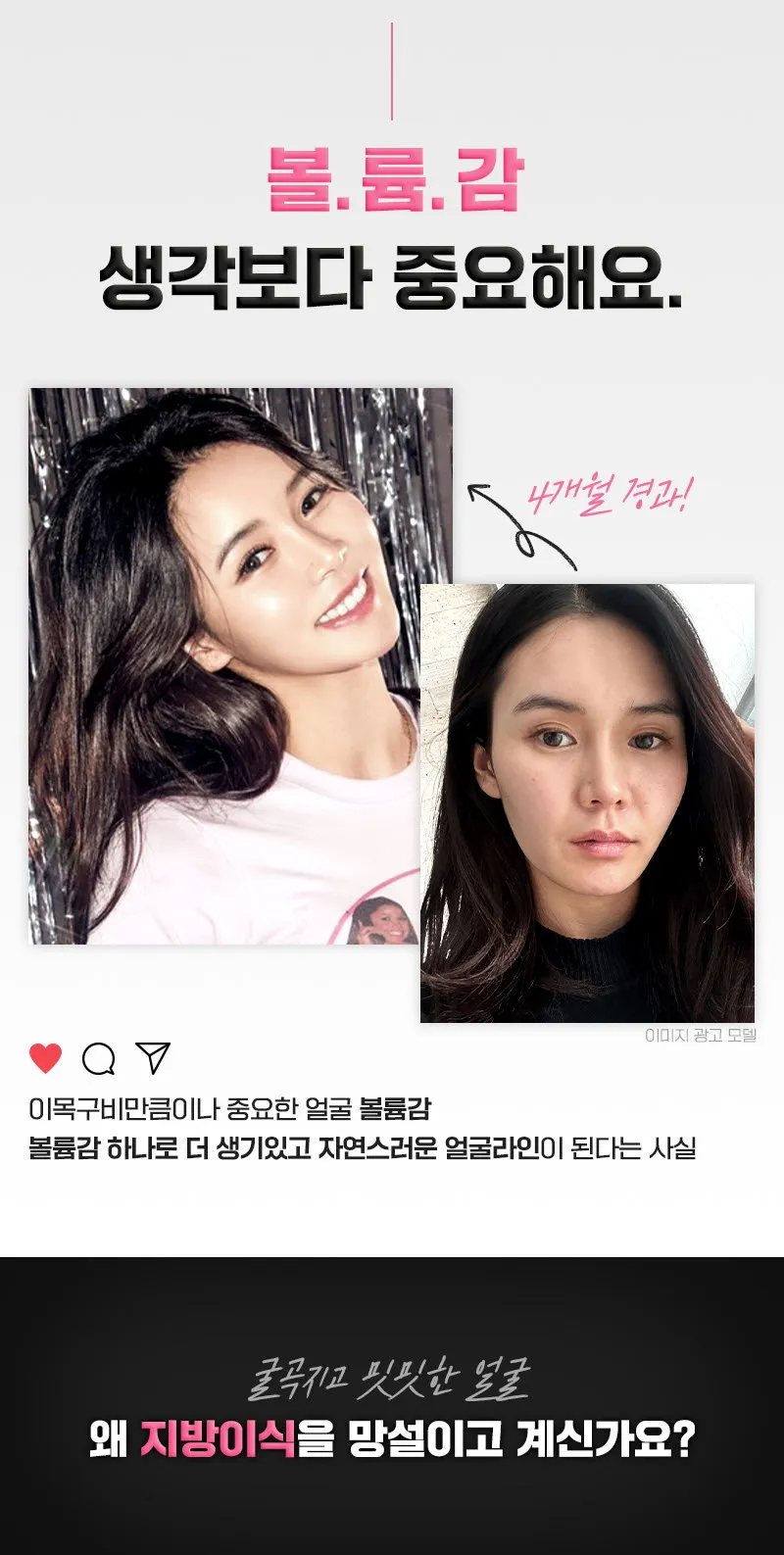 뷰성형외과 ❤️뷰❤️얼굴 지방이식 이벤트, 시술 상세 이미지