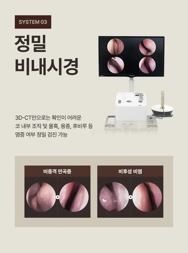 ❤️뷰❤️기능코성형