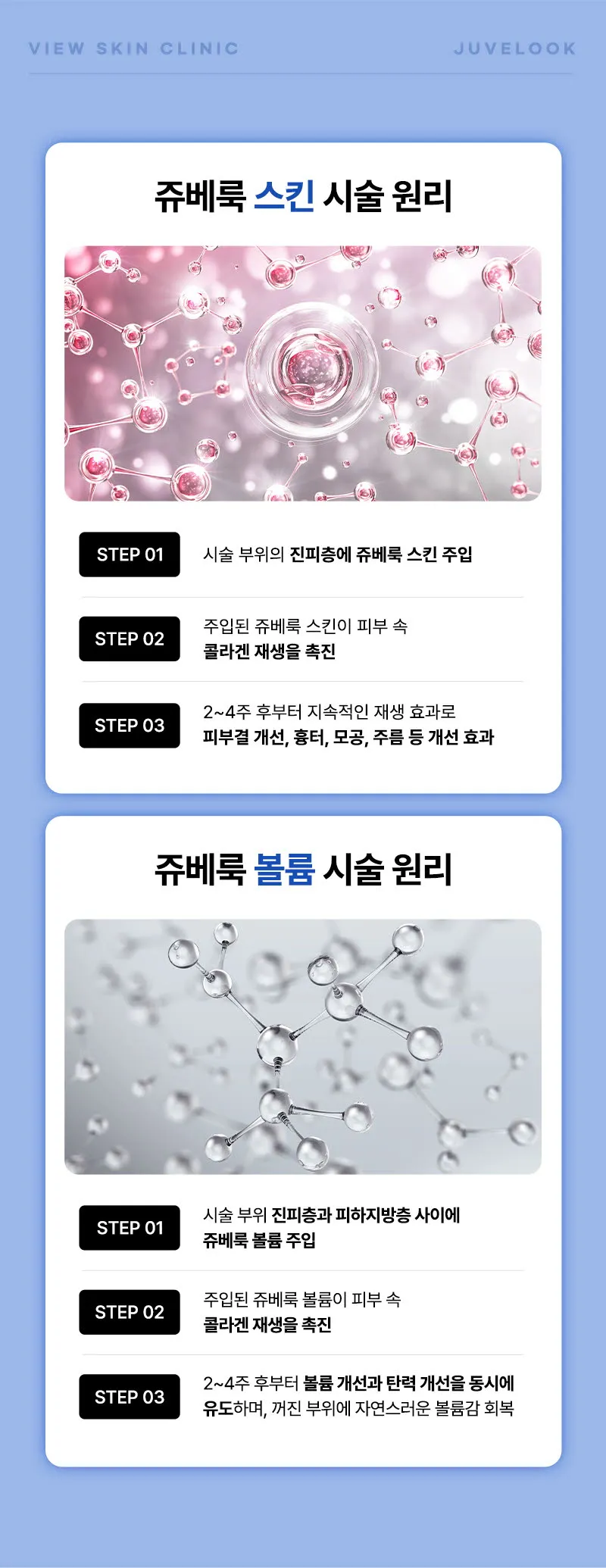 뷰성형외과 ❤뷰❤쥬베룩볼륨&스킨 이벤트, 시술 상세 이미지