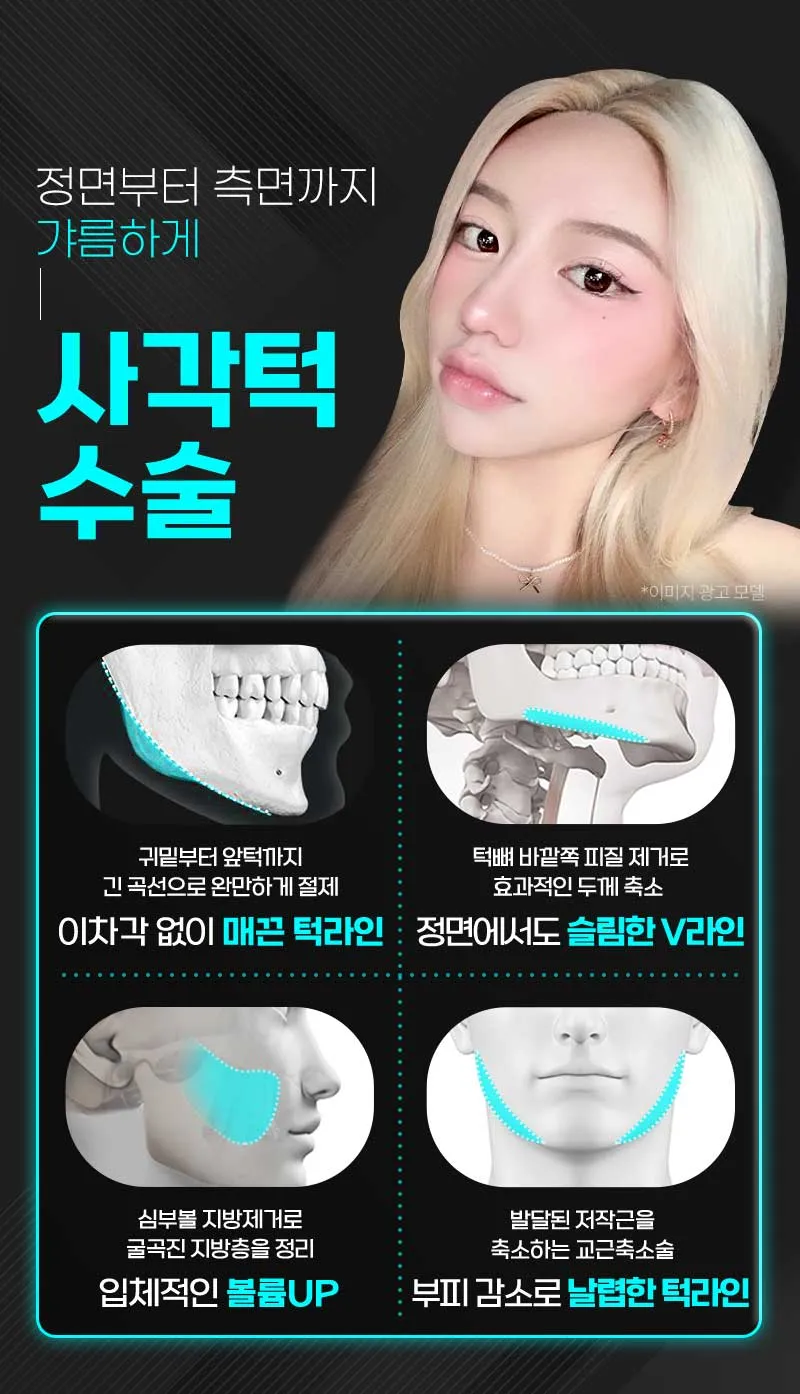 뷰성형외과 ❤️뷰❤️안면윤곽 이벤트, 시술 상세 이미지