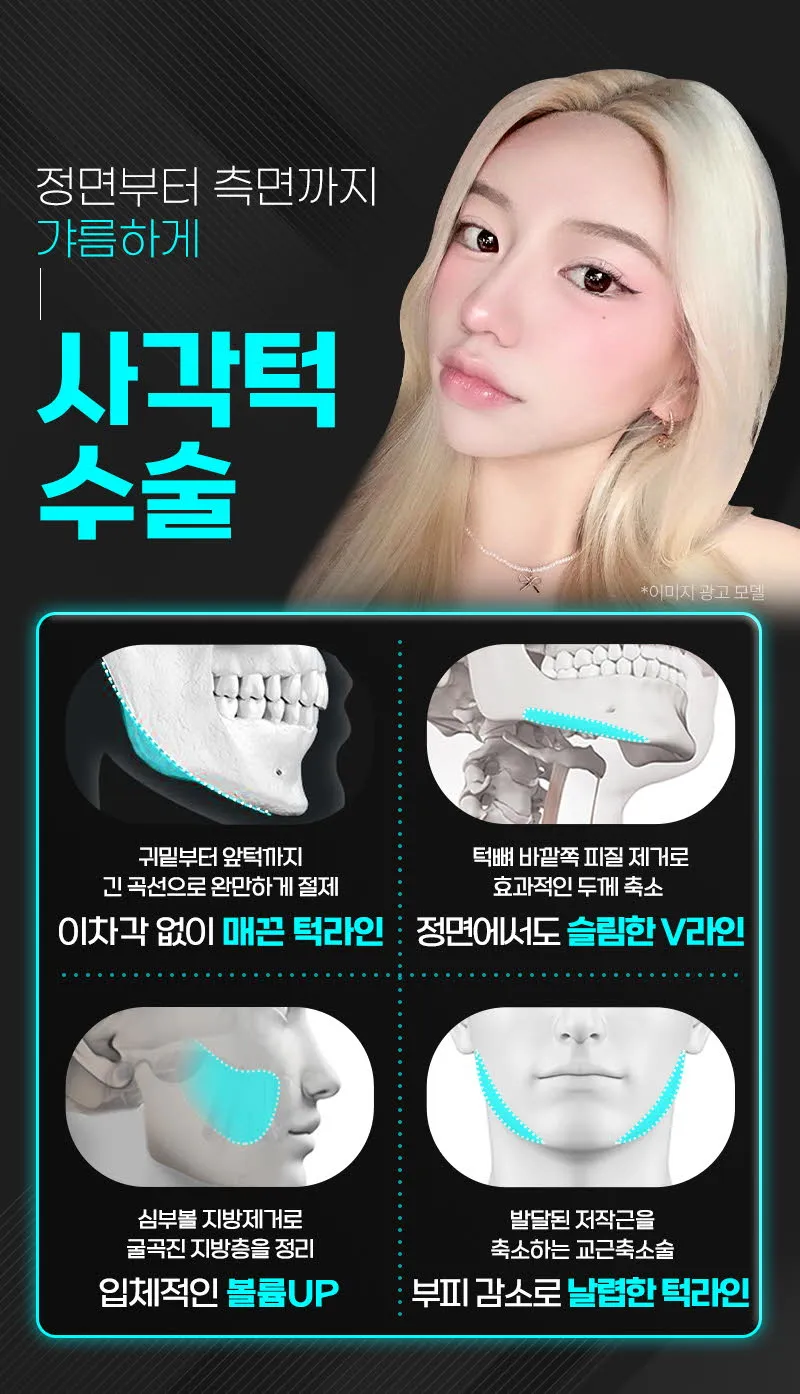 뷰성형외과 ❤️뷰❤️안면윤곽 이벤트, 시술 상세 이미지