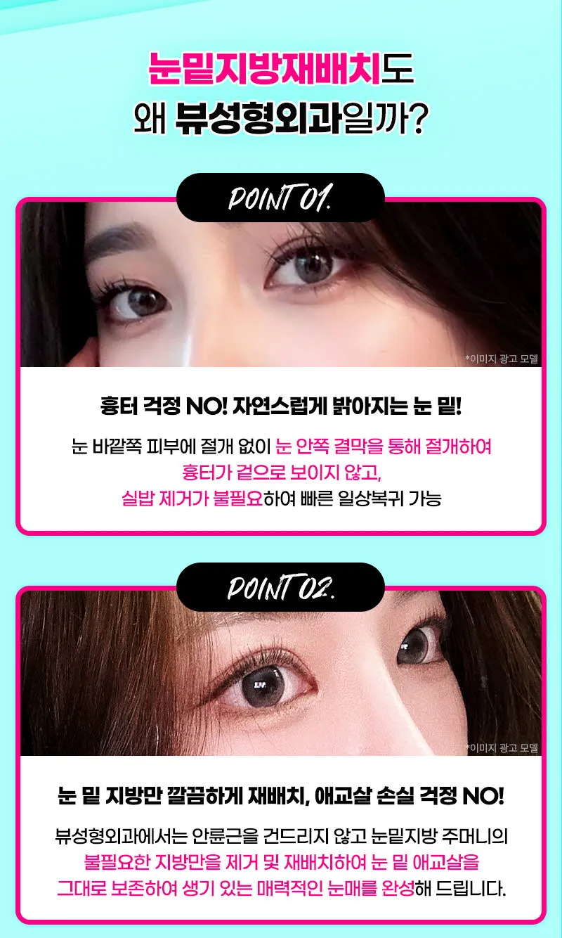 뷰성형외과 ❤️뷰❤️눈밑지방재배치 이벤트, 시술 상세 이미지
