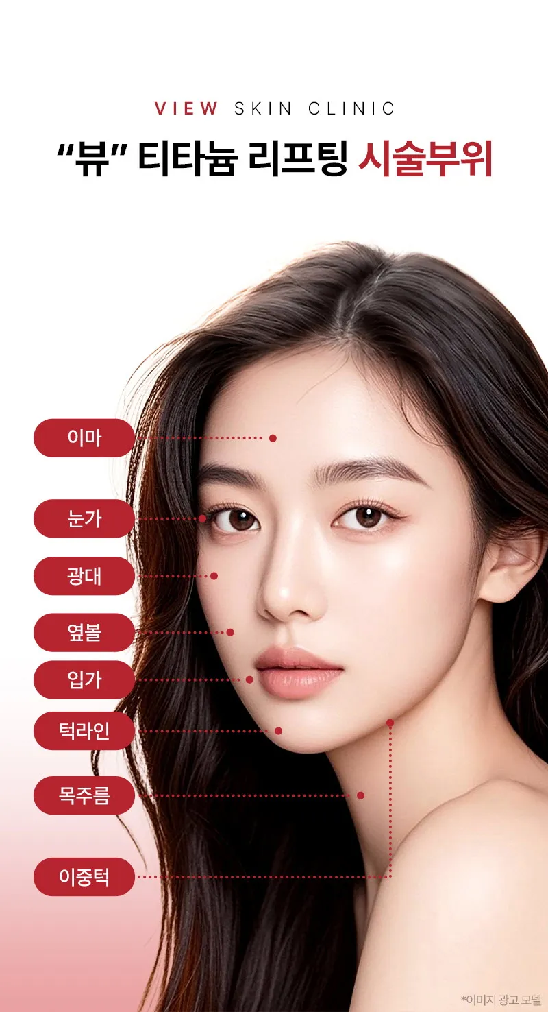 뷰성형외과 ❤뷰❤티타늄리프팅 이벤트, 시술 상세 이미지