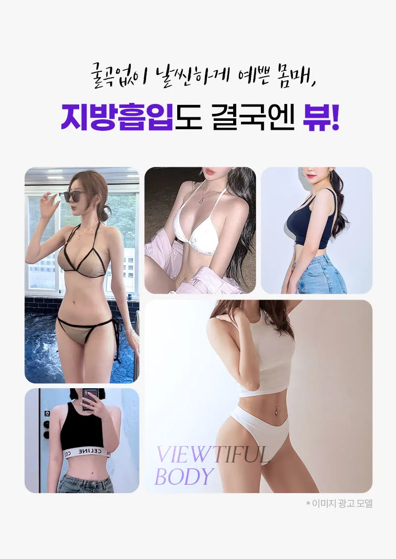 뷰성형외과 ❤️뷰❤️대용량 지방흡입 이벤트, 시술 상세 이미지