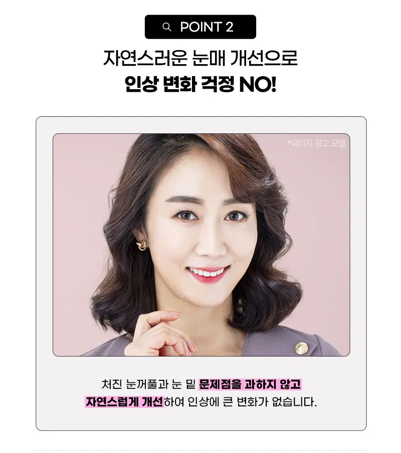 뷰성형외과 ❤️뷰❤️중년 눈성형 이벤트, 시술 상세 이미지