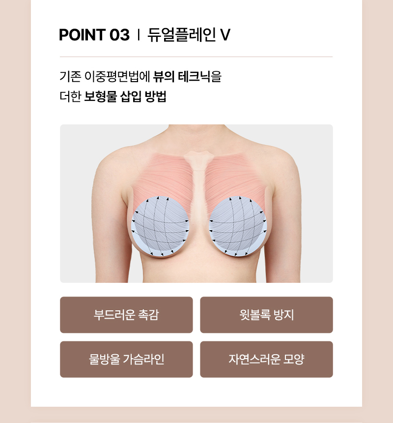 뷰성형외과 ❤뷰❤여의사 UIU 가슴성형 이벤트, 시술 상세 이미지