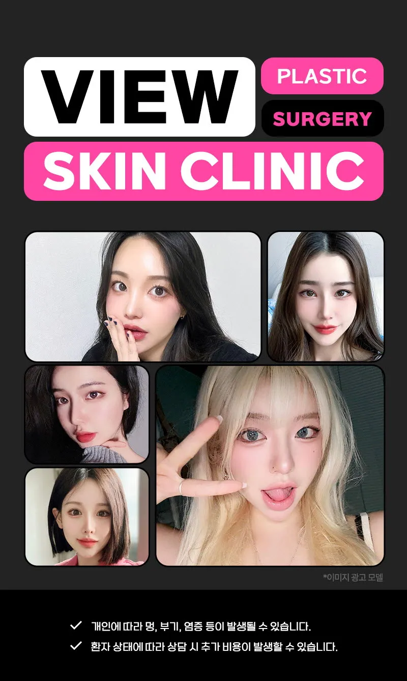 뷰성형외과 ❤뷰❤입술필러 이벤트, 시술 상세 이미지