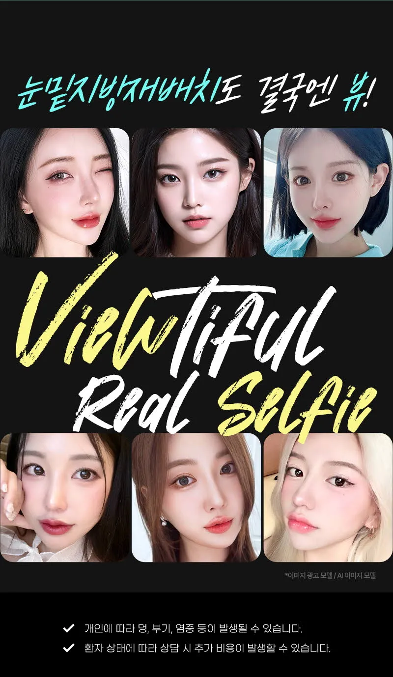 뷰성형외과 ❤️뷰❤️눈밑지방재배치 이벤트, 시술 상세 이미지