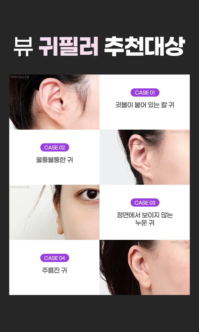 뷰성형외과 ❤뷰❤귀필러 (수입정품) 이벤트, 시술 상세 이미지