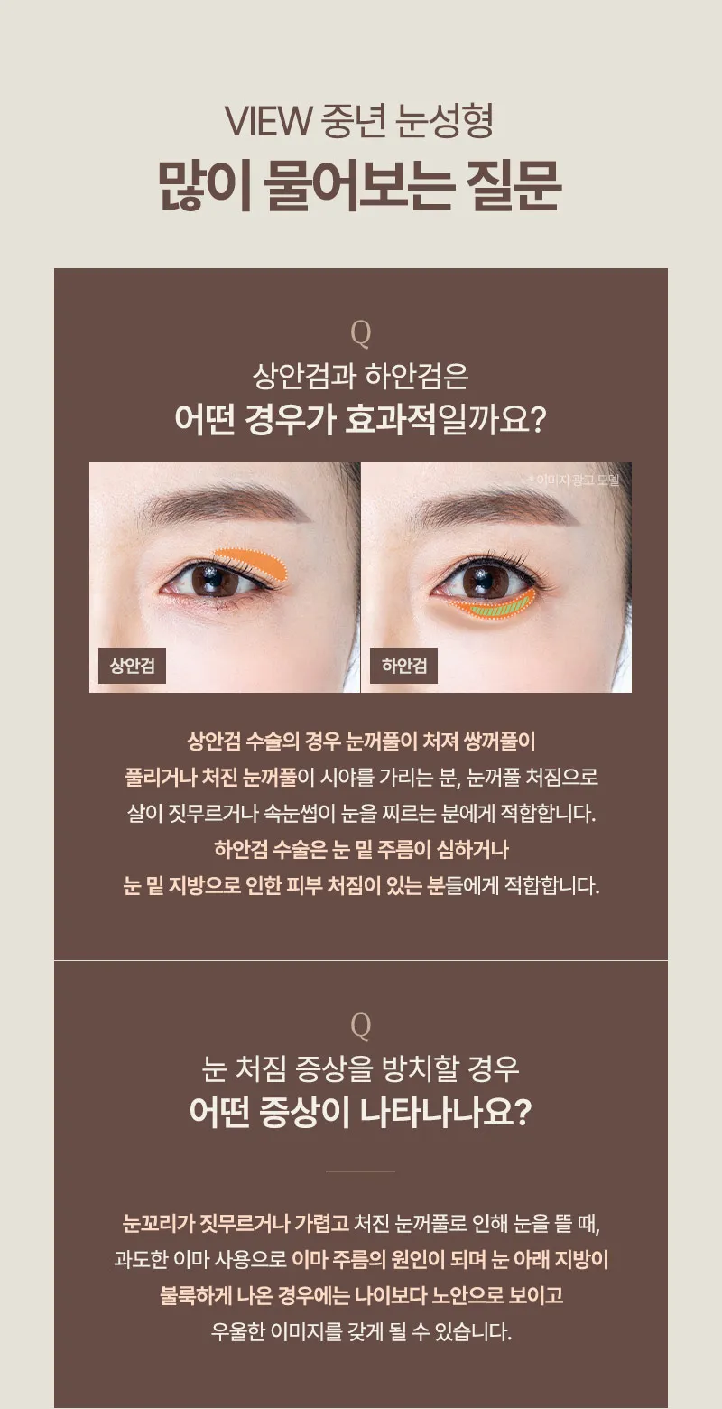 ❤️뷰❤️중년 눈성형