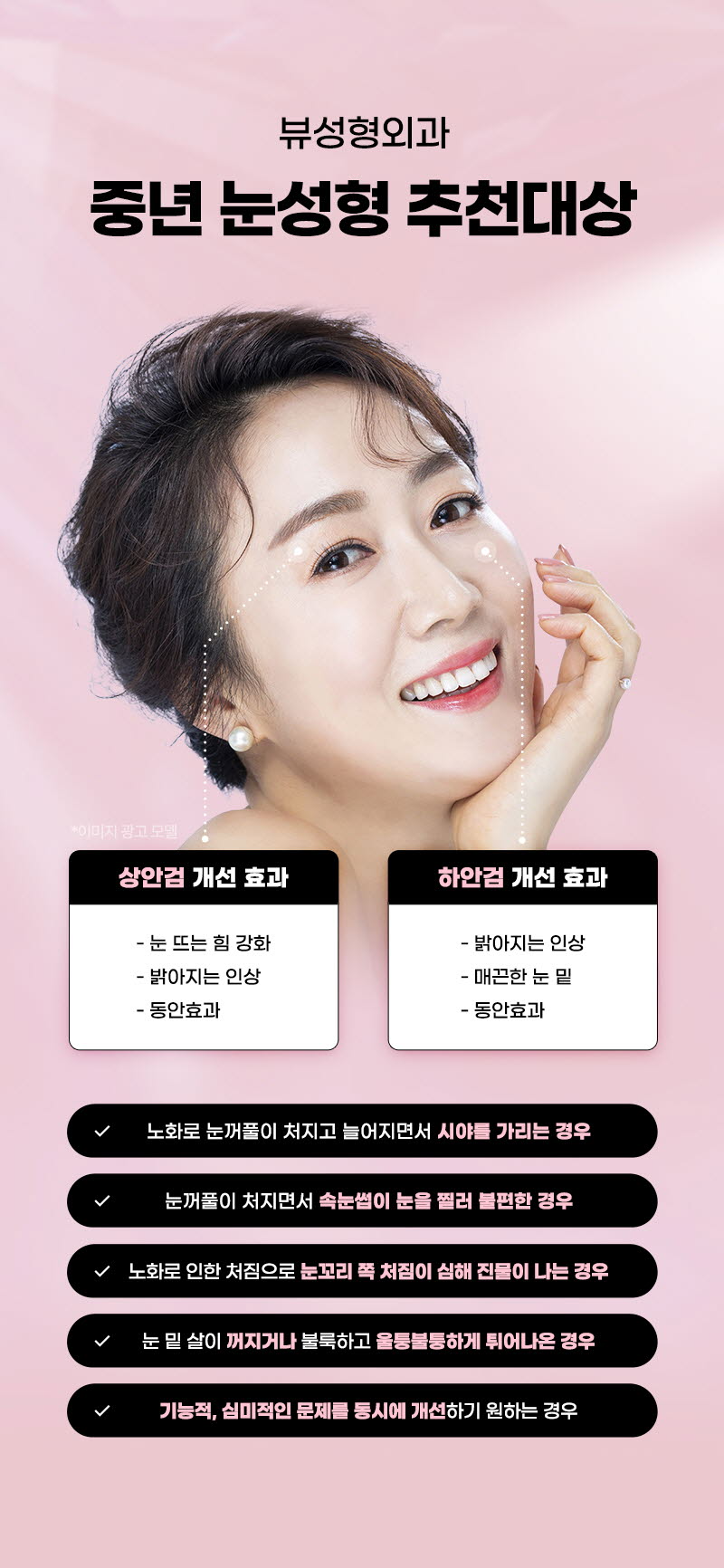 뷰성형외과 ❤️뷰❤️중년 눈성형 이벤트, 시술 상세 이미지
