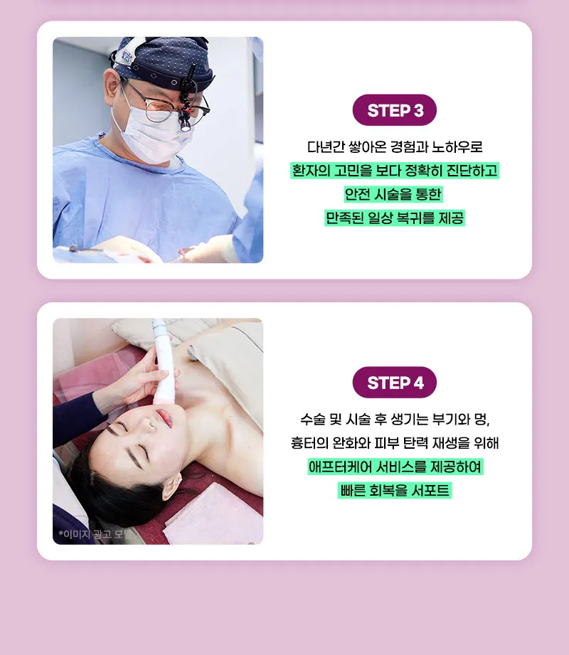 뷰성형외과 ❤뷰❤미니거상 이벤트, 시술 상세 이미지