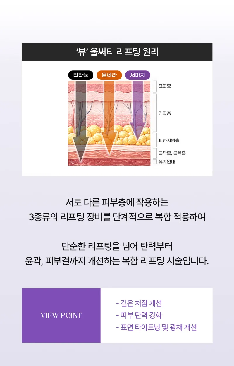 뷰성형외과 ❤뷰❤울써티리프팅 (수면마취) 이벤트, 시술 상세 이미지