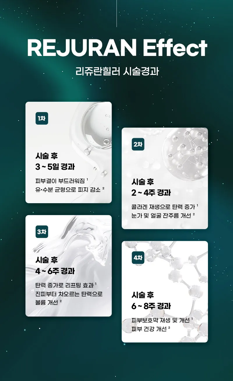 뷰성형외과 ❤️뷰❤️리쥬란힐러 4cc 이벤트, 시술 상세 이미지