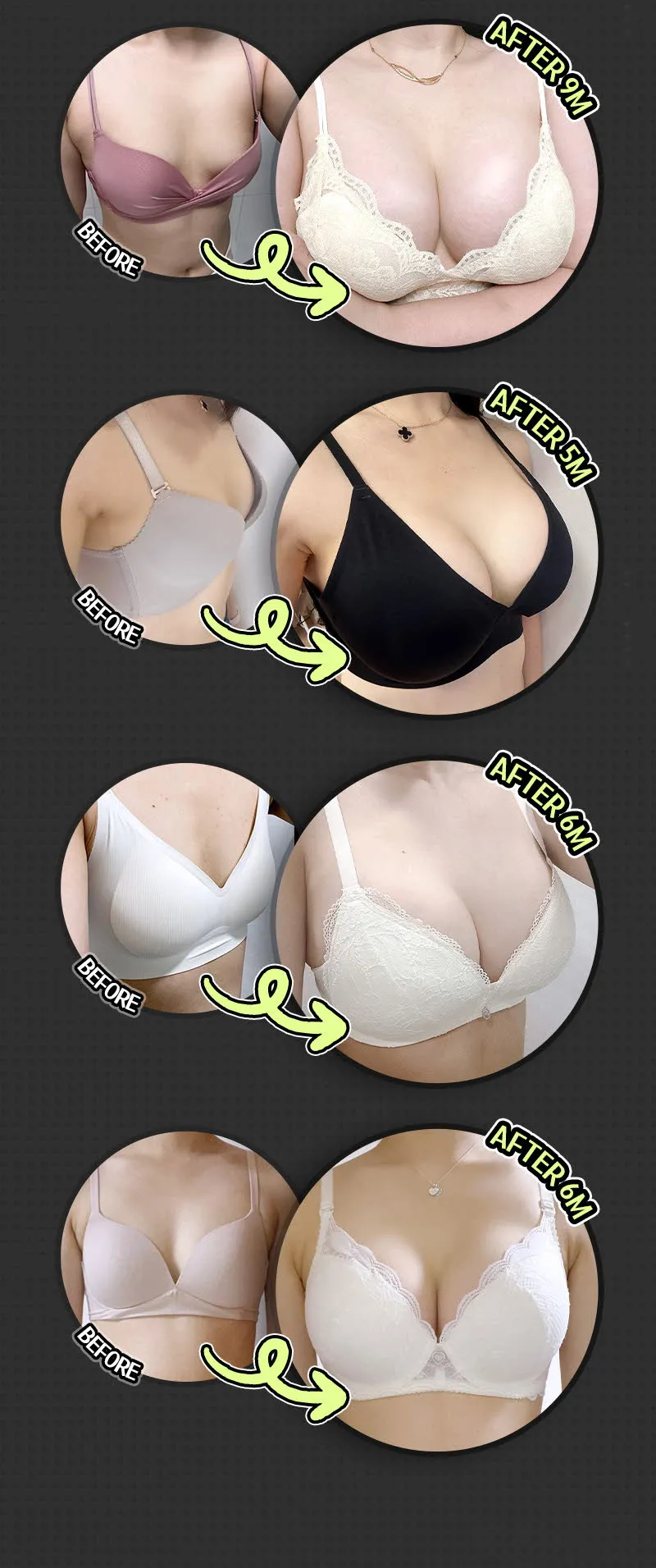 뷰성형외과 ❤️뷰❤️세빈 인테그리티 이벤트, 시술 상세 이미지