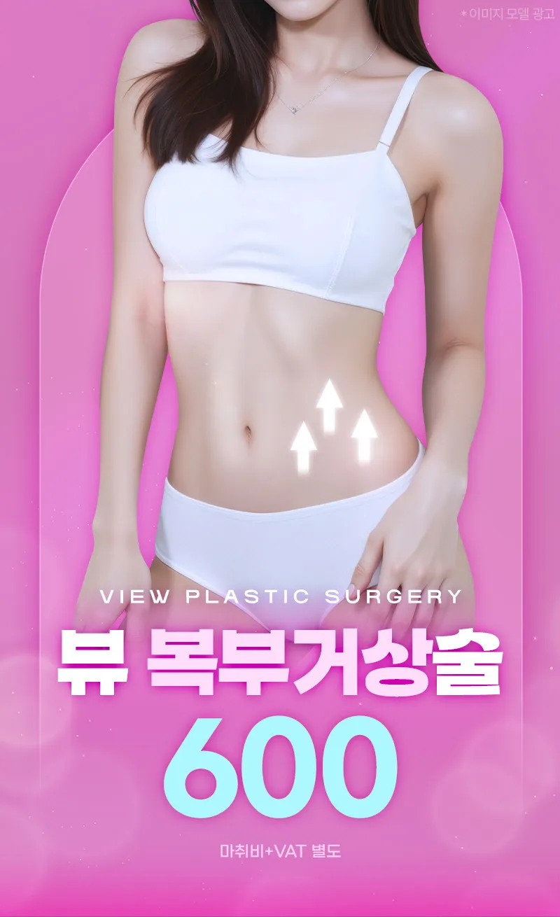 뷰성형외과 ❤뷰❤복부거상술 이벤트, 시술 상세 이미지