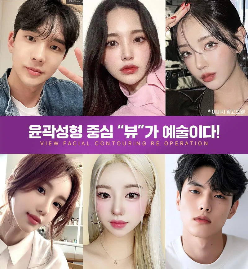뷰성형외과 ❤️뷰❤️안면윤곽 재수술 이벤트, 시술 상세 이미지