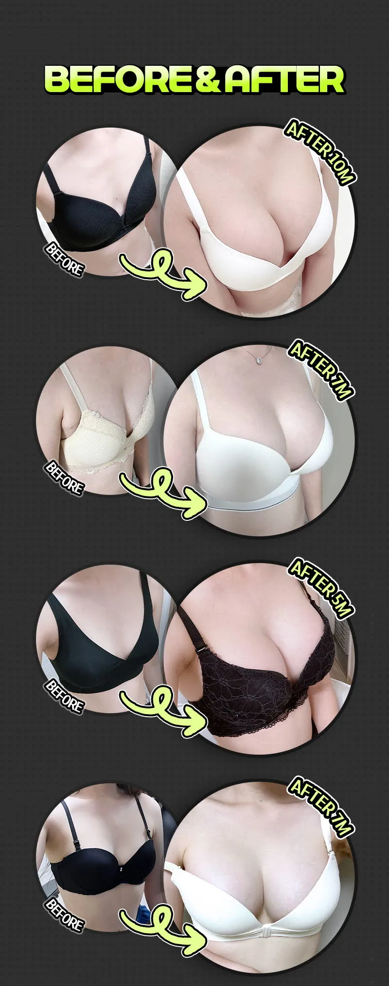 뷰성형외과 ❤️뷰❤️세빈 인테그리티 이벤트, 시술 상세 이미지