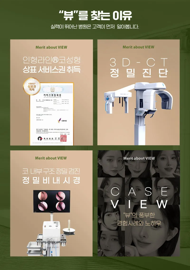 뷰성형외과 ❤️뷰❤️기능코성형 이벤트, 시술 상세 이미지
