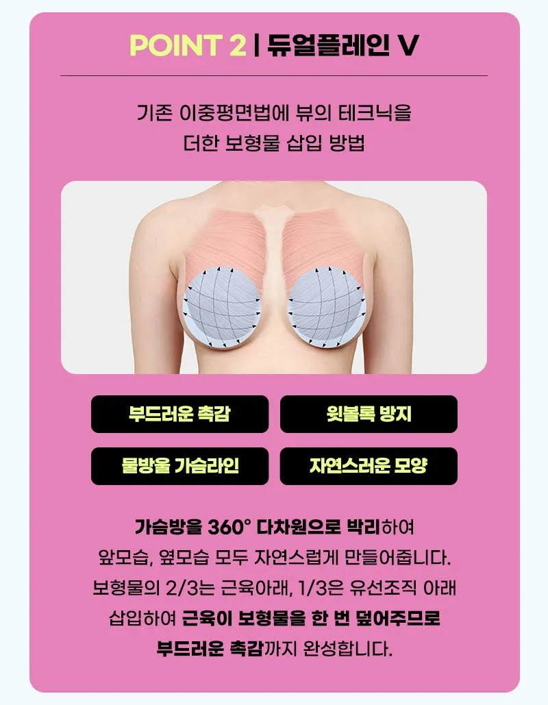 뷰성형외과 ❤️뷰❤️UIU 가슴성형 240 이벤트, 시술 상세 이미지