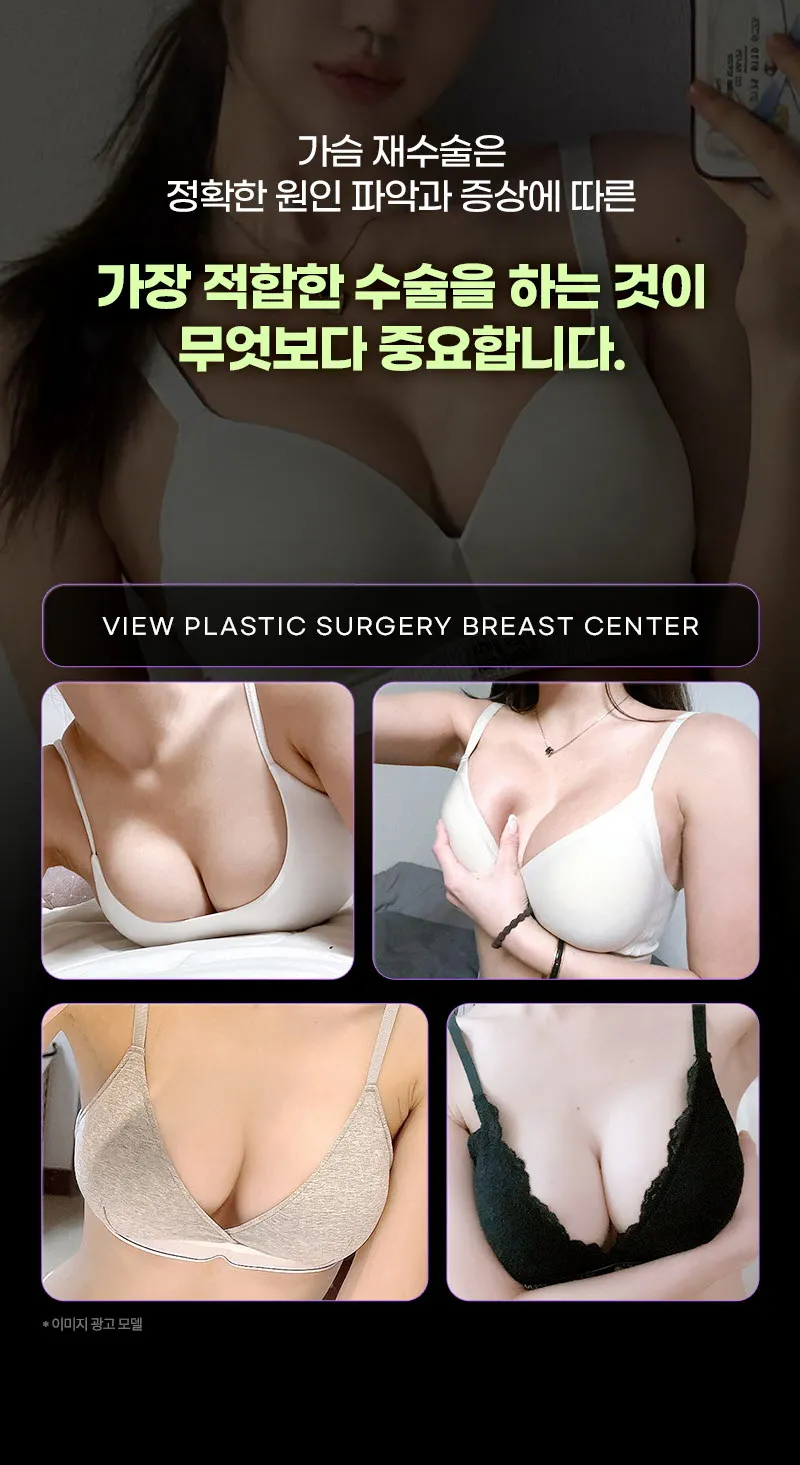 뷰성형외과 ❤뷰❤모티바 가슴 재수술 이벤트, 시술 상세 이미지