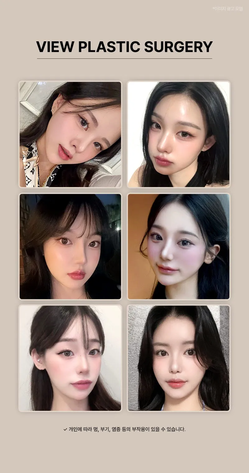 뷰성형외과 ❤뷰❤커스텀볼륨리프팅 이벤트, 시술 상세 이미지