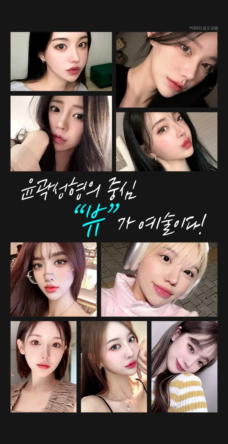 뷰성형외과 ❤️뷰❤️안면윤곽 이벤트, 시술 상세 이미지