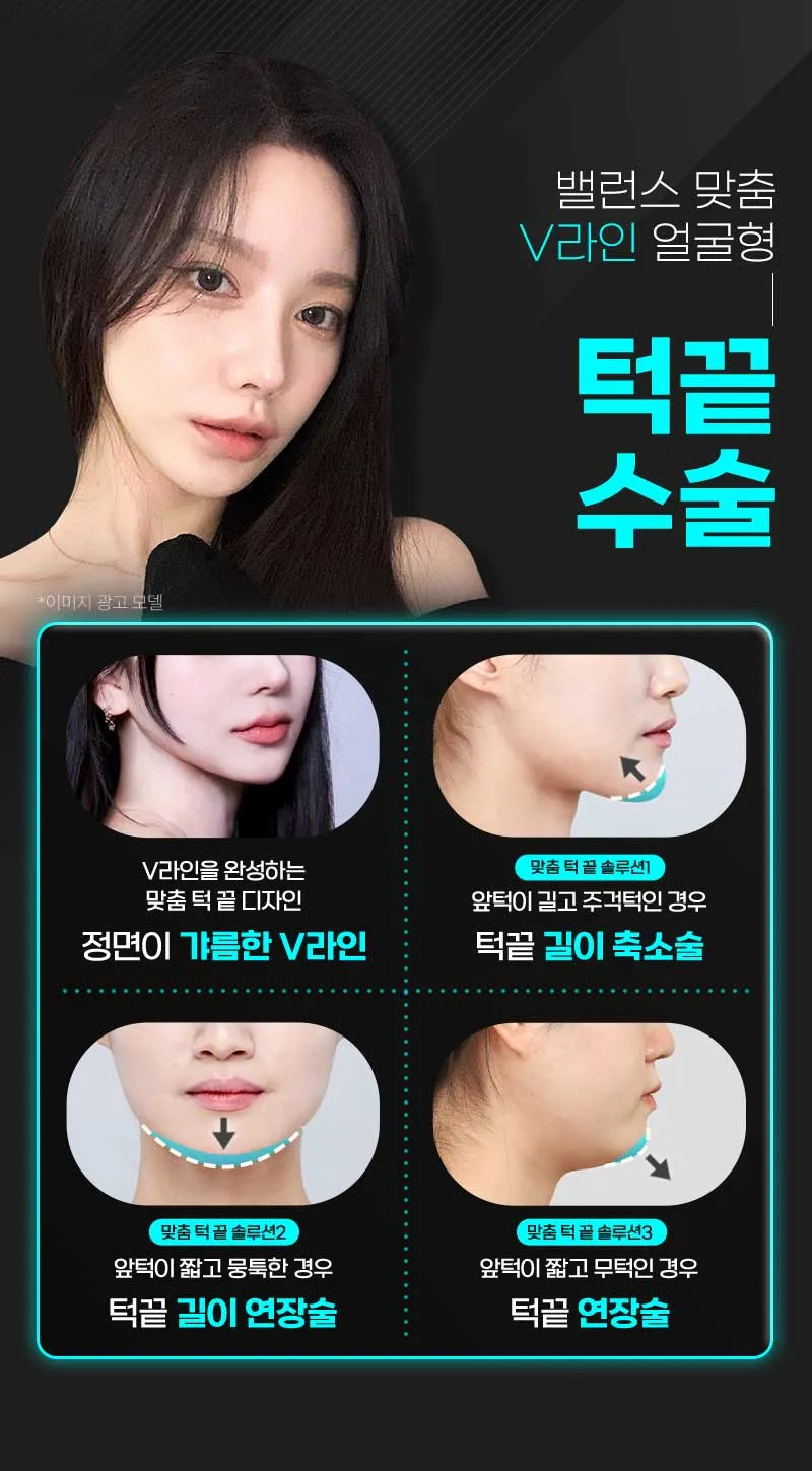 뷰성형외과 ❤️뷰❤️안면윤곽 이벤트, 시술 상세 이미지