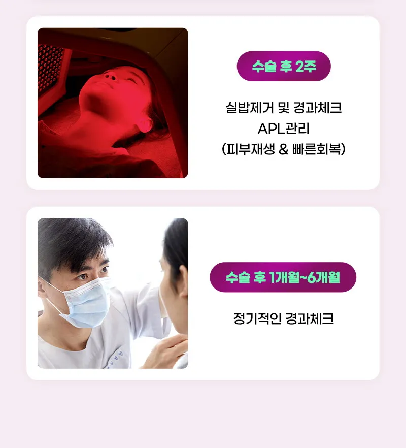 뷰성형외과 ❤뷰❤미니거상 이벤트, 시술 상세 이미지